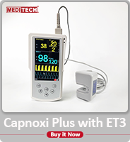 Capmoxi with external sidestreamCO2 sensor "Et7"