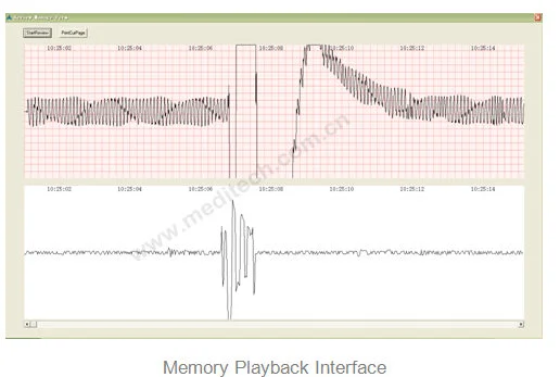 Memory Playback includes ECG, grid, speech waveform, corresponding time mark, Auto play button, and button for printing current page.